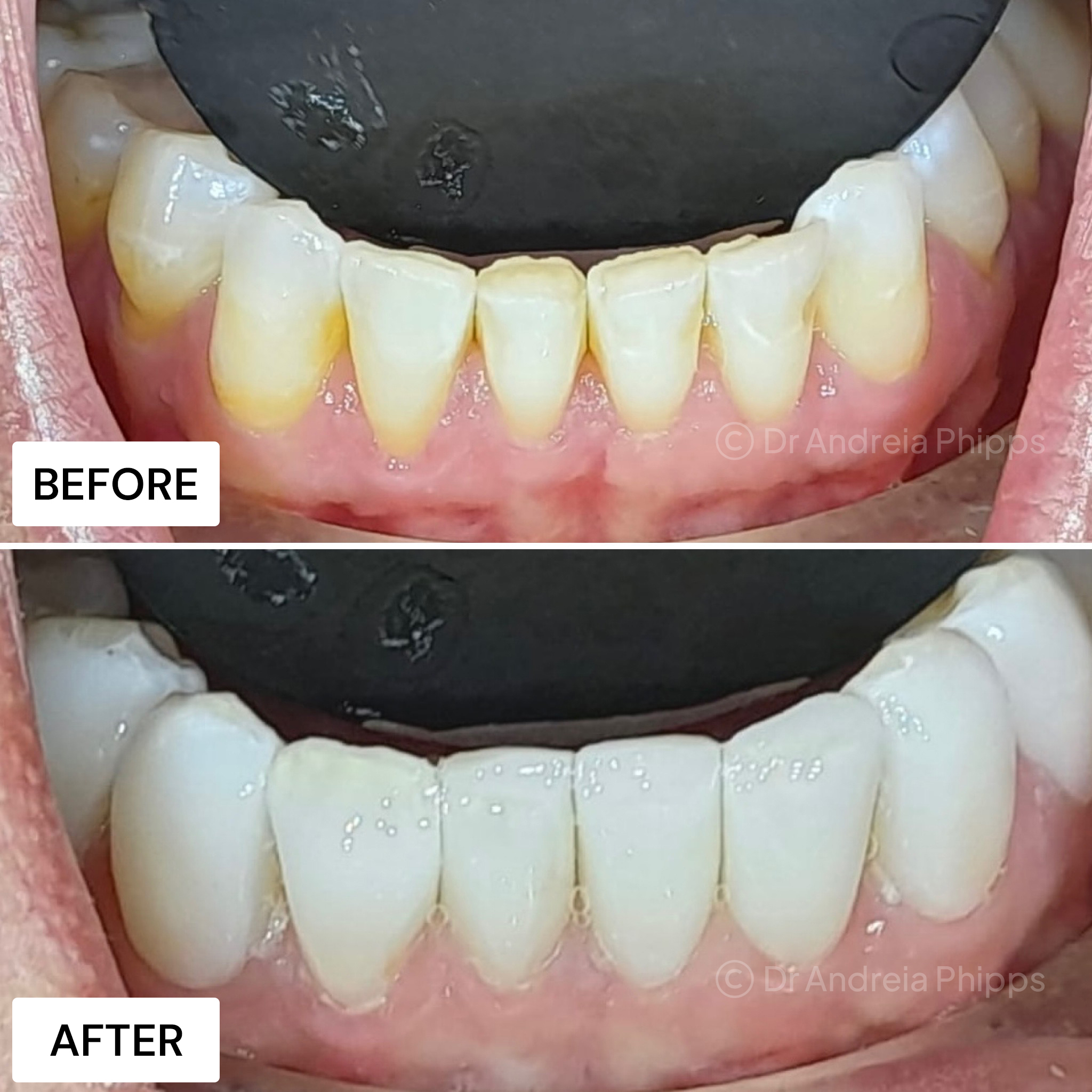 Smile Gallery