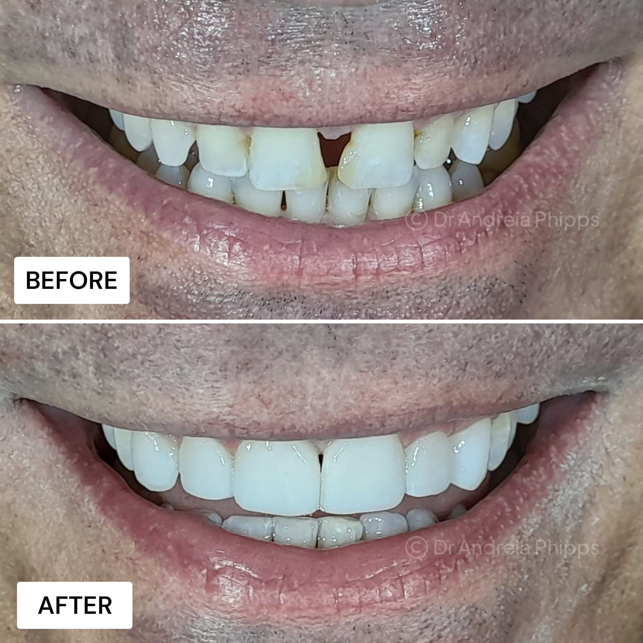 Smile Gallery