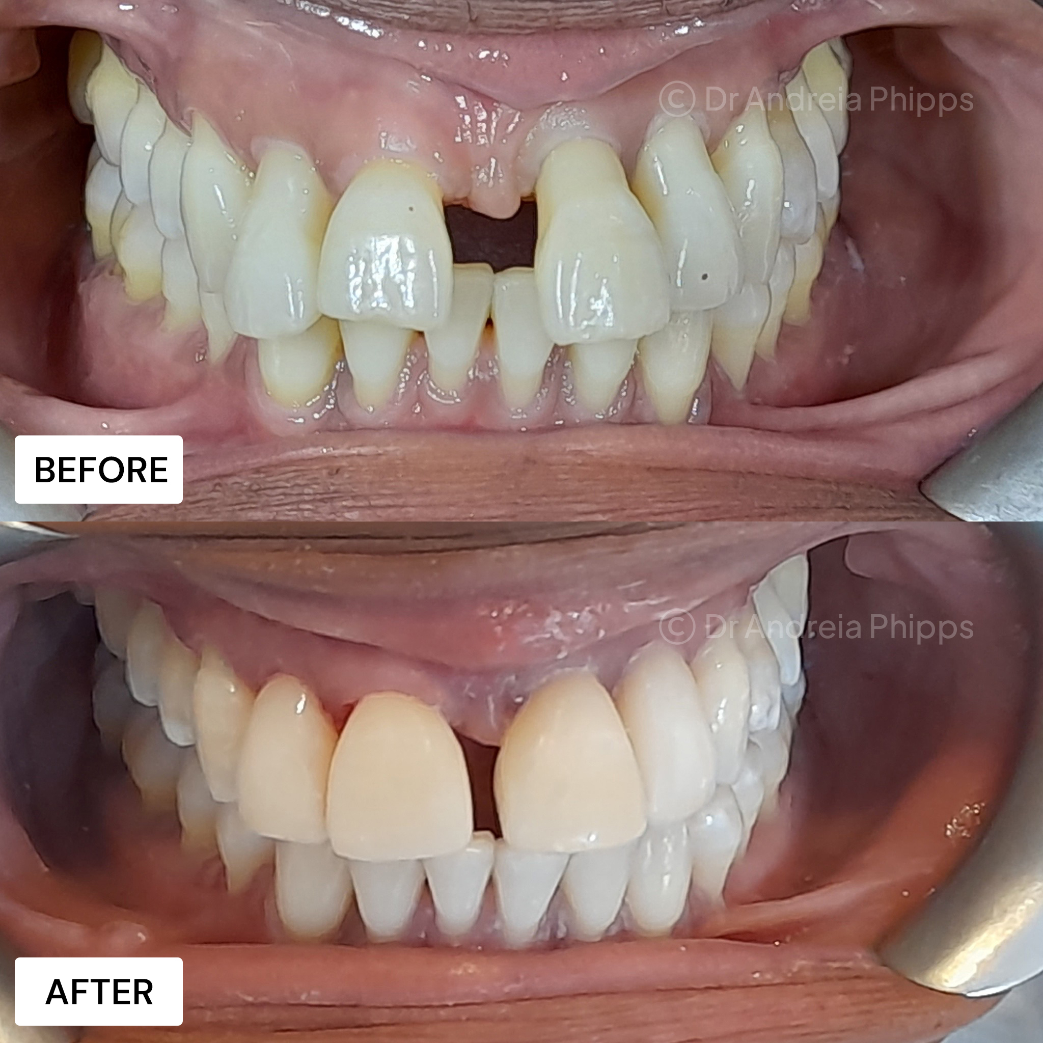 Smile Gallery