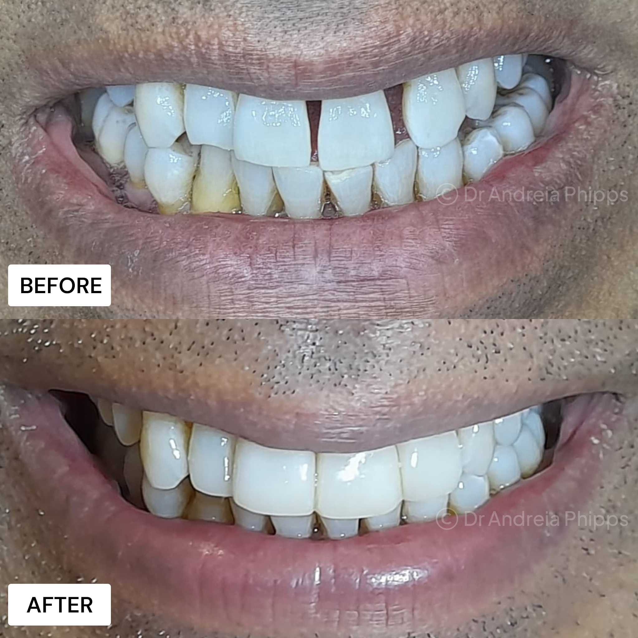 Smile Gallery