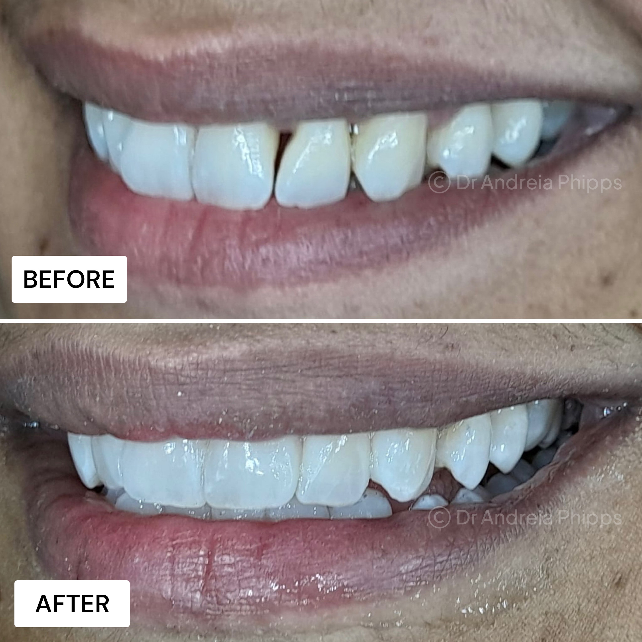 Smile Gallery