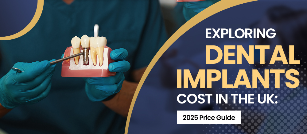 What are the Dental Implants Cost in the UK? 2025 Price Guide