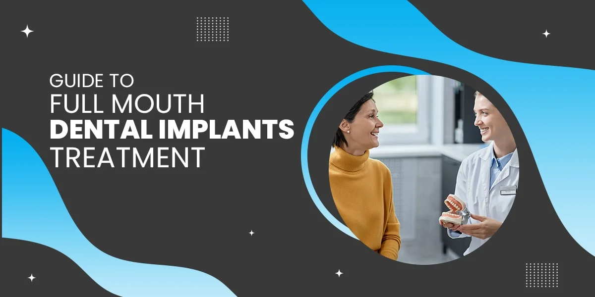 Guide to Full Mouth Dental Implants Treatment