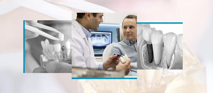 Dental Implant Maintenance Instructions