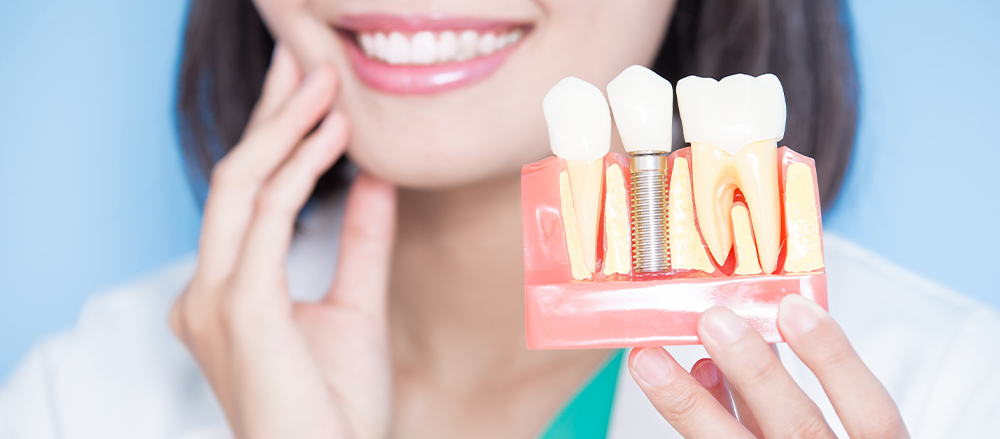 Types of Dental Implants: Which One Is Right for You?