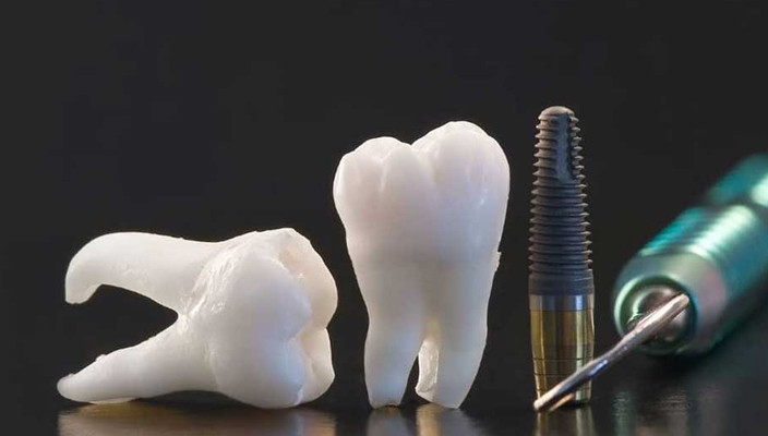 Dental Treatment costs