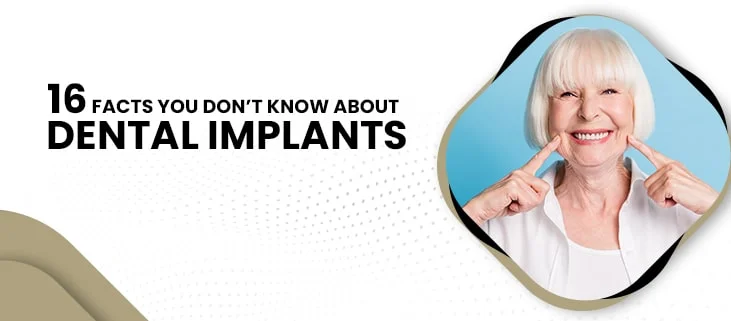 16 Facts You Don&rsquo;t Know about Dental Implants
