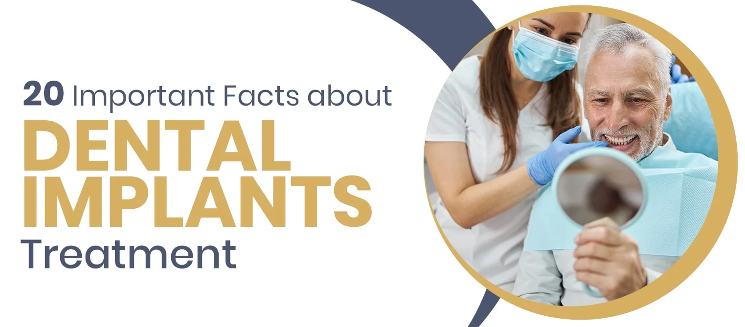 20 Important Facts about Dental Implants Treatment