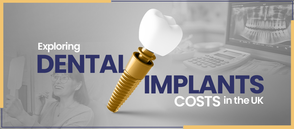 Exploring Dental Implant Costs in the UK