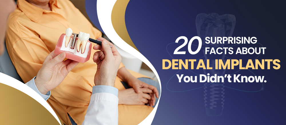 20 Surprising Facts about Dental Implants You Didn’t Know